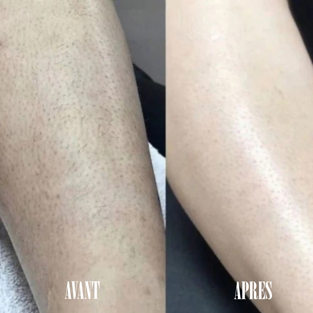 SilkyGlow™ – Épilateur Précision Haute Douceur